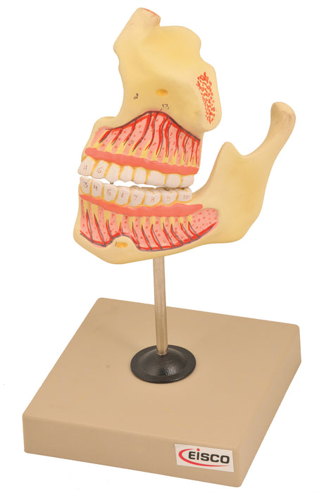 Model Upper & Lower Jaw - 3 times enlarged