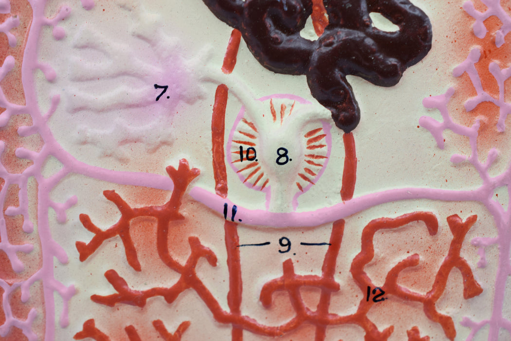 Liver Fluke Worm Model, 10"x7" - Numbered Structures - Hand Painted