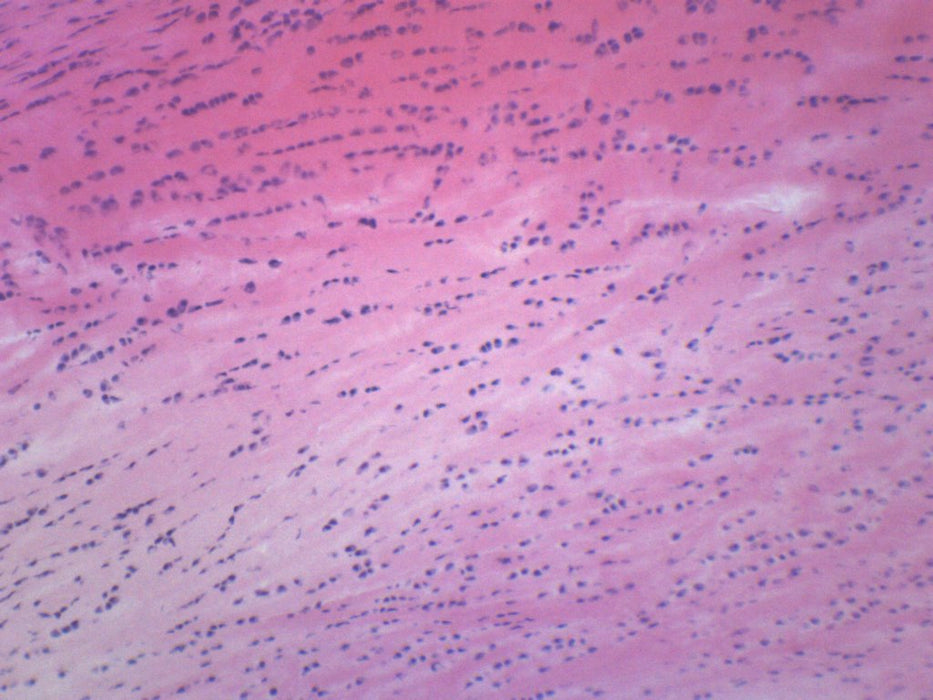 White Fibrocartilage, Mammal - Prepared Microscope Slide