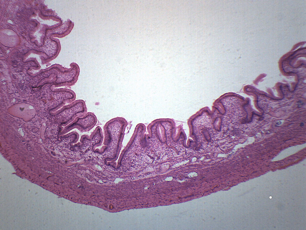 gallbladder histology labeled