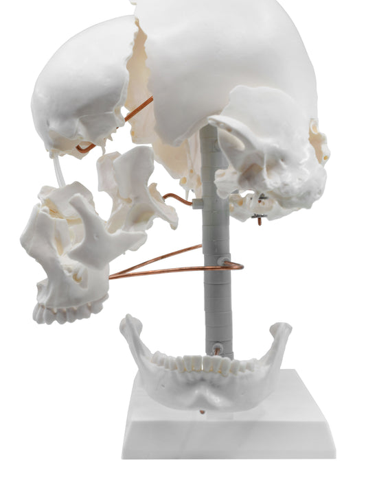 beauchene skull rotated