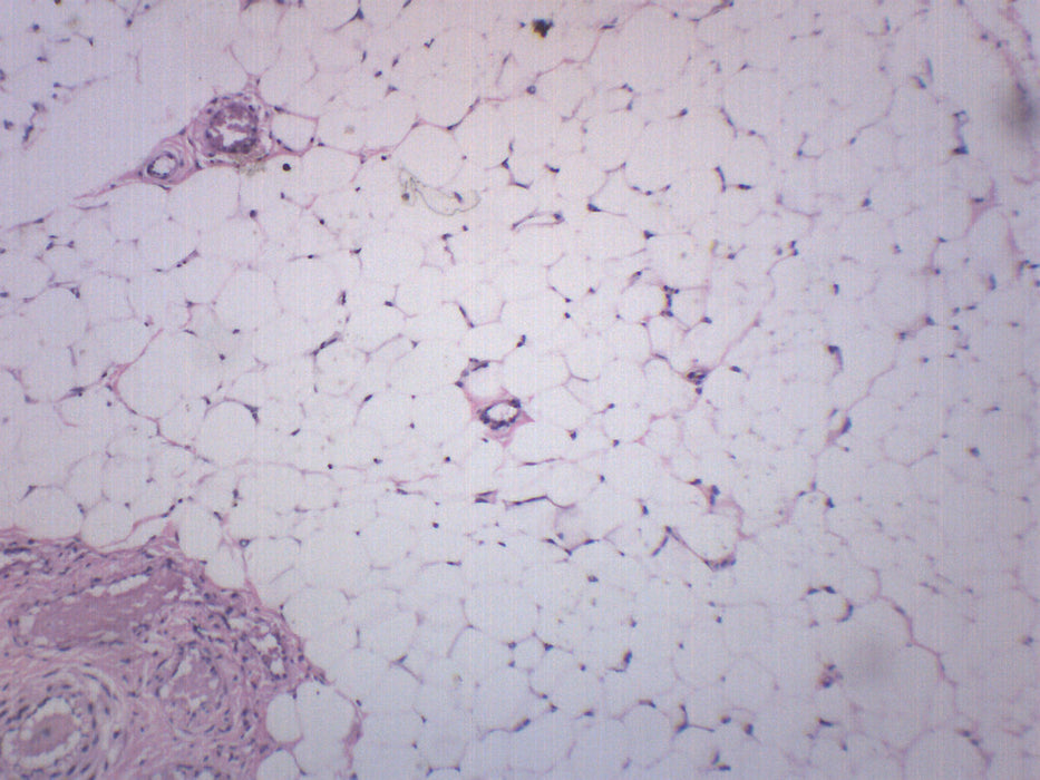 Adipose Tissue Section, Human - Prepared Microscope Slide