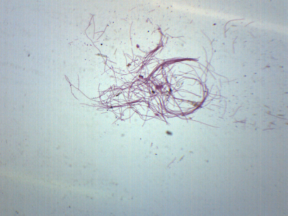 oscillatoria bacteria labeled